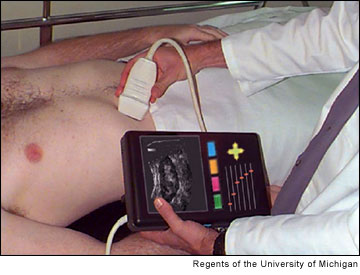 Hand-held ultrasonic body scanner