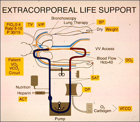 A diagram of the circuit for prolonged extracorporeal circulation